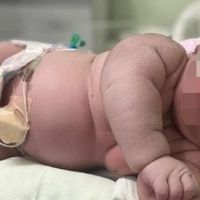 Brazilka rodila bebu tešku preko sedam kilograma