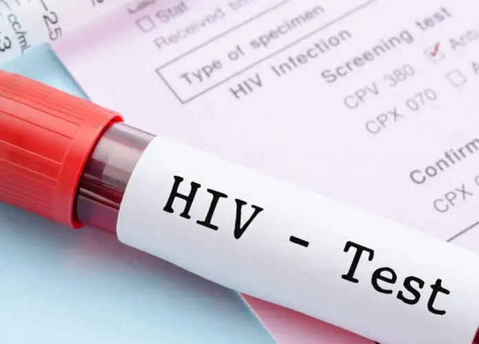 Suočavanje sa predrasudama: Smanjiti stigmu kako bi se rizične grupe testirale na HIV – Puls Šumadije